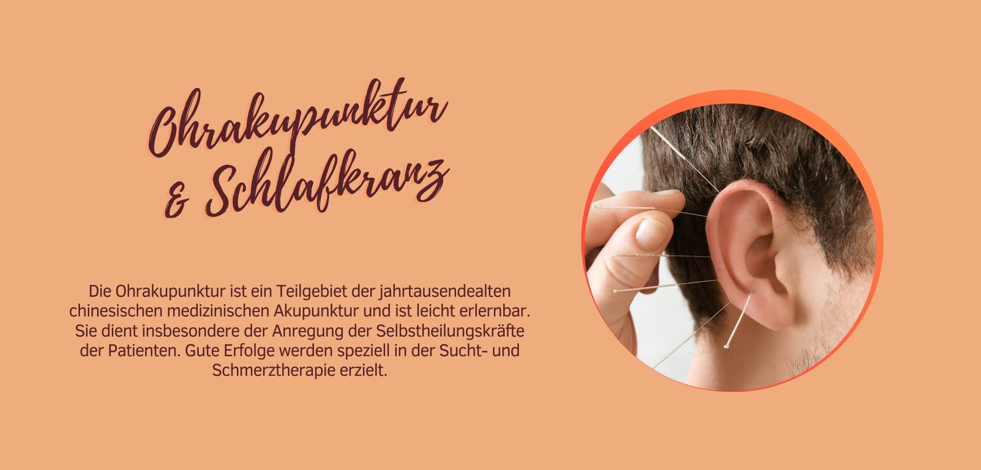 Foto Ohrakupunktur